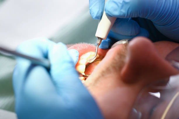 Best Teeth Whitening  in Ferrum, VA